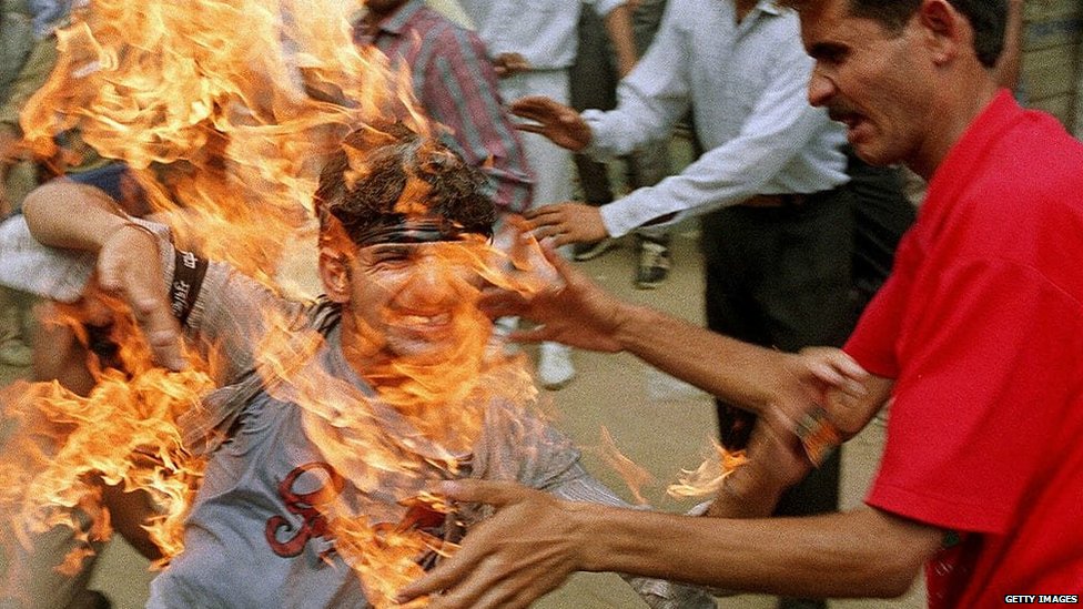 मंडल आयोग के विरोध में आत्मदाह मंडल आयोग के विरोध में आत्मदाह